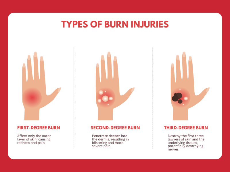 Burn-Injury-Lawyer